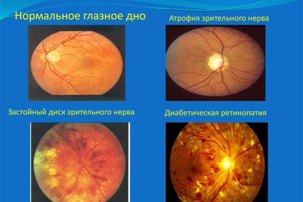 Кракен сайт официальный зеркало